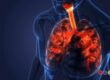 Respiratory-and-other-Emergencies-Awareness-onboard